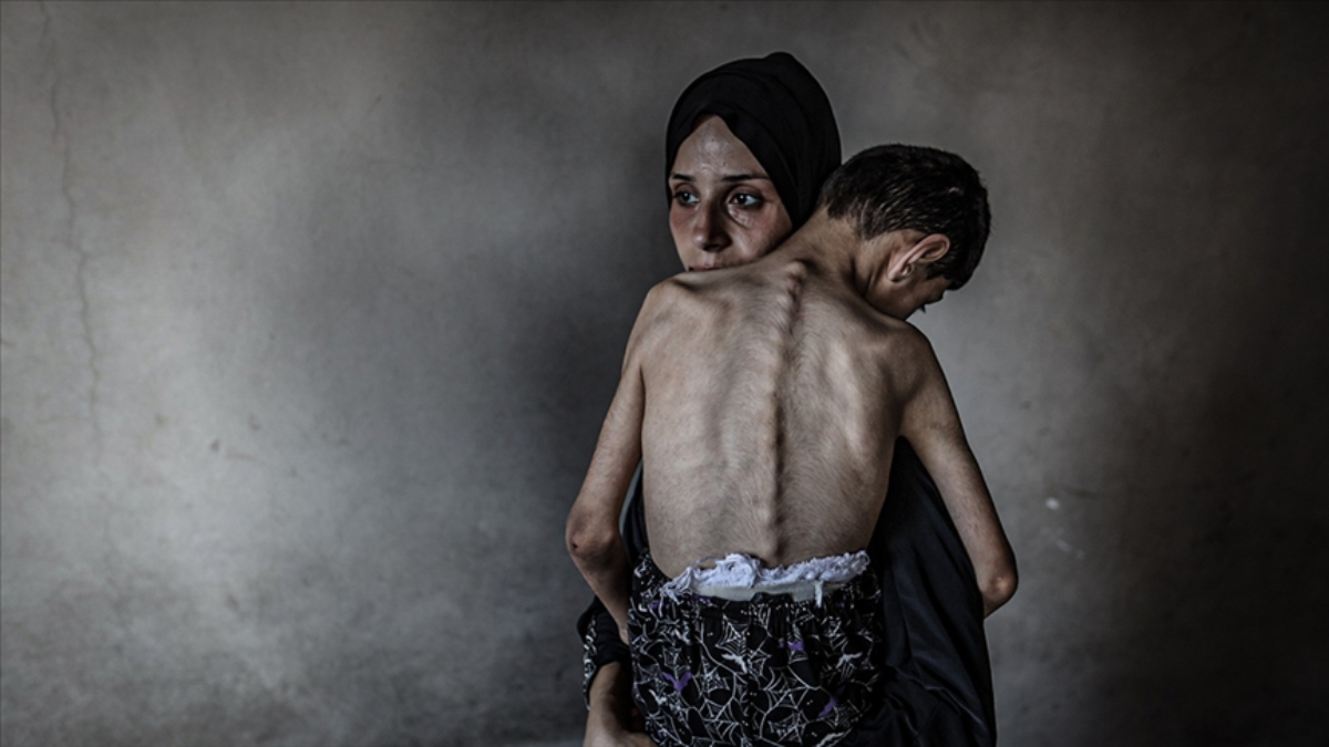 gazzede israilin ac birakma politikasi suruyor 2 kisi daha hayatini kaybetti b9dICQbW