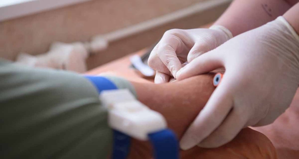 40 yasindan sonra herkesin yaptirmasi gereken 3 kan testi 5Dr5OZKd.jpg